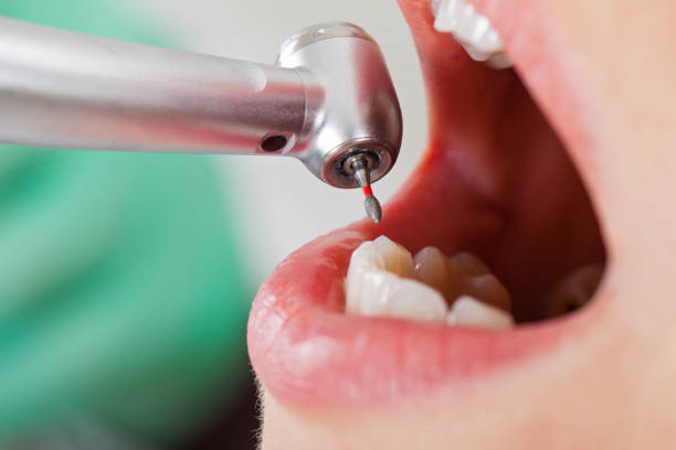 Best Cosmetic Emergency Dentistry in Gaylord, MI